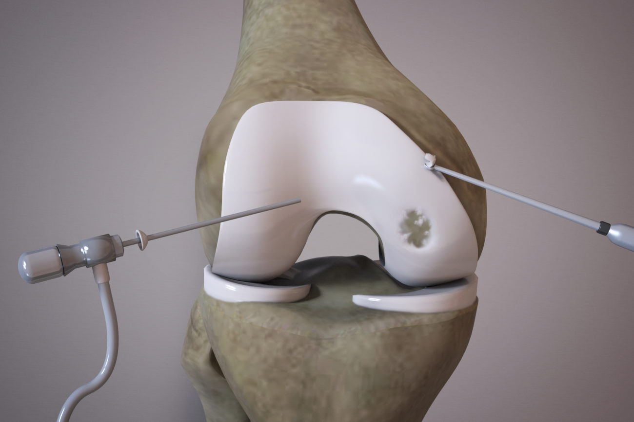 Biopsy and cell propagation