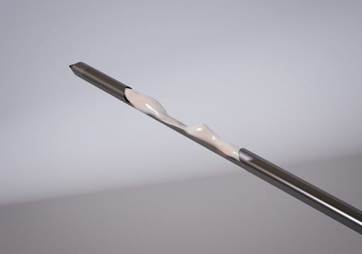 Biopsy sample as seen with external blade retracted
