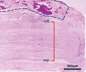 Comparator-wrapped rat sciatic nerve image