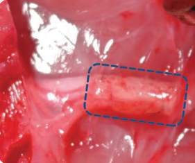 Comparator-wrapped rat sciatic nerve image